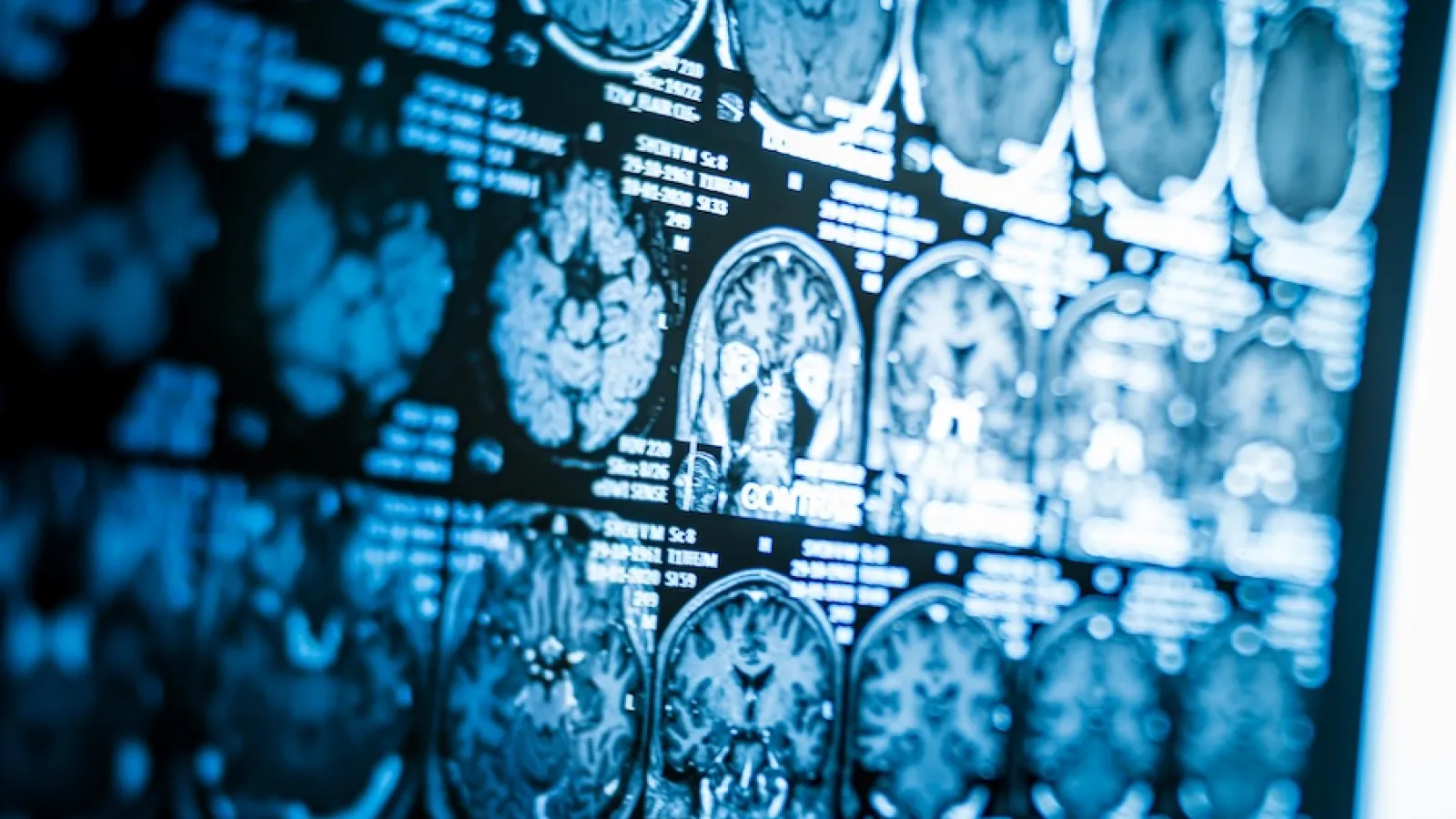 Complicated xray of a human brain with rows and rows of images