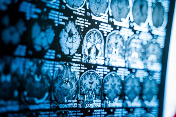 Complicated xray of a human brain with rows and rows of images